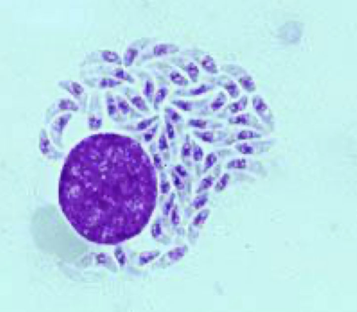<p>What parasite is this?</p>