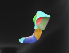 <p>What bony landmark is in dark purple (medial)?</p>