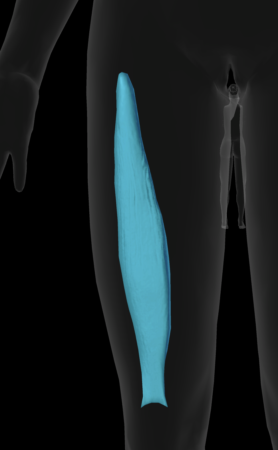 <p>Vastus Intermedius Origin</p>