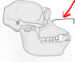 <p><br><span>When the lower portion of the face markedly projects forward.</span></p>