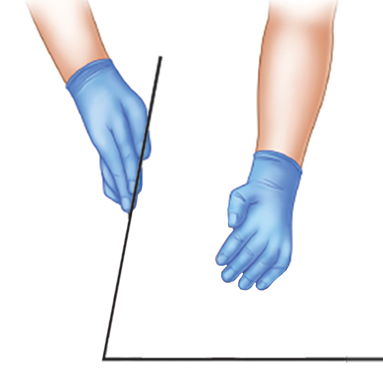 <p>Past-neutral position</p>
