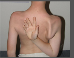 <p>reaching behind back to touch opposite scap</p>