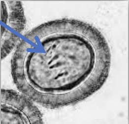 <p>What type of egg is this? </p>