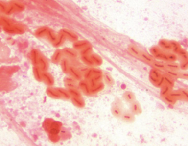 <p><span><strong>Overproduction of alginate</strong></span>, forming a <span><strong>capsule around bacteria</strong></span>.</p>