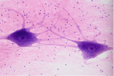 <p>specialized to carry electrical signals called action potentials, made up of neurons</p>