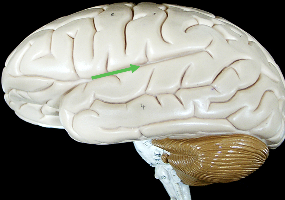 <p>Identify the small space on the brain indicated by the pointer.</p>