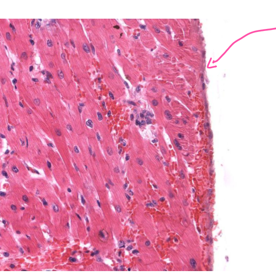 <p>What tissue is indicated by the arrow?</p>