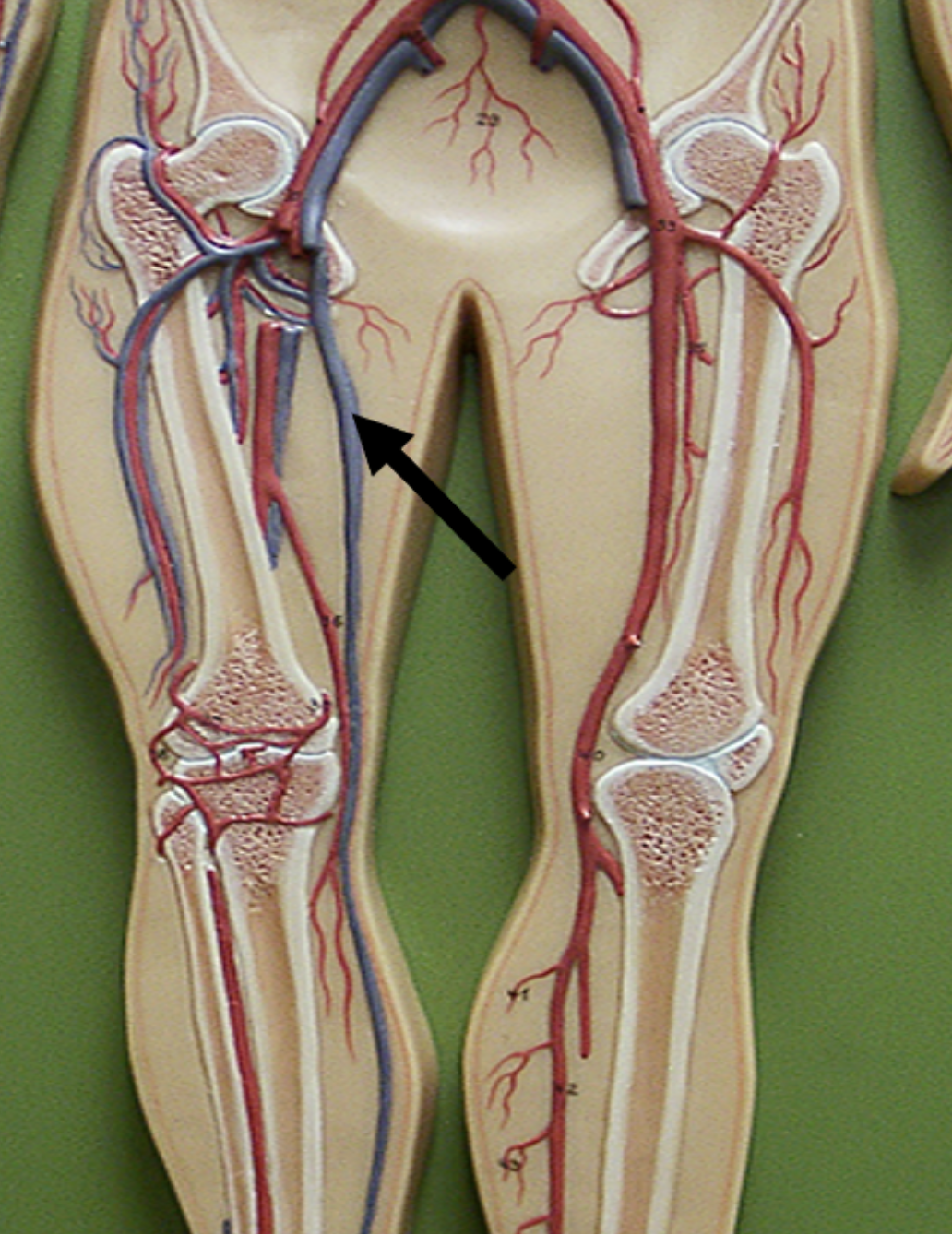 <p><span>Identify the blood vessel indicated by the pointer.</span></p>