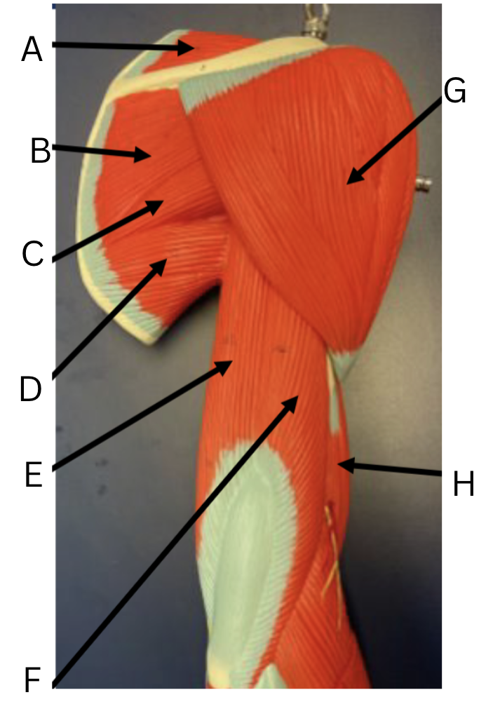 <p><span>Label the shoulder and arm muscles</span></p>