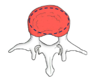 <ul><li><p>eight bearing</p></li><li><p>articulate superiorly and inferiorly</p></li><li><p>epiphyseal ring (dotted circle), helps ith attachment to intervertebral disk</p></li></ul><p></p>