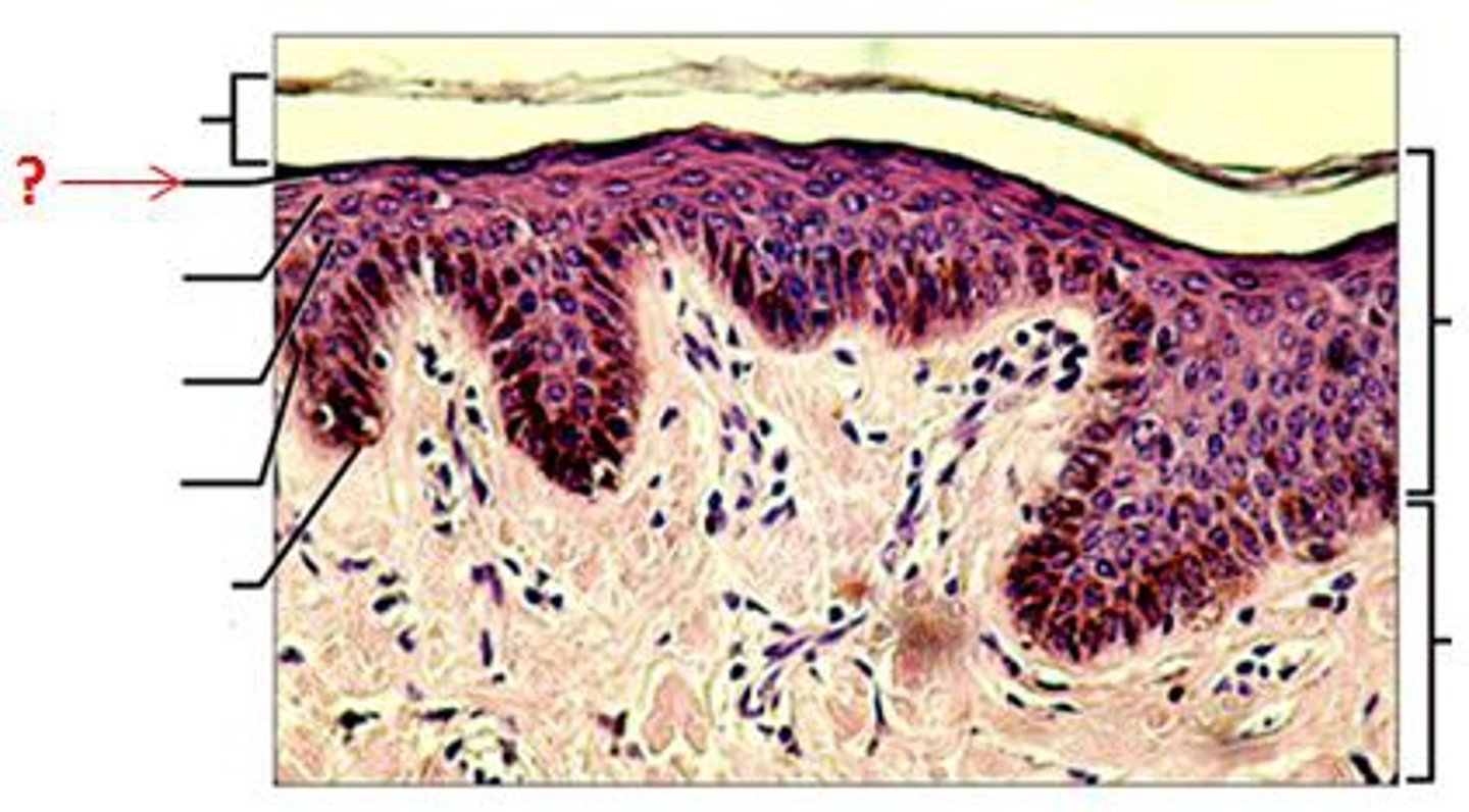 <p>a thin, clear layer of dead skin cells in the epidermis named for its translucent appearance under a microscope found in thick skin</p>