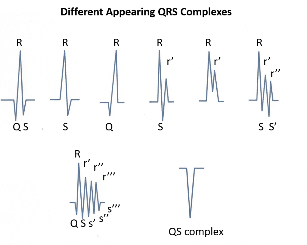 <ul><li><p>als bepaalde uitslagen heel klein zijn t.o.v. gehele QRS-complex → kleine letter</p></li><li><p>QRS-complex dat volledig negatief is: QS-complex</p></li><li><p>R: uitsluitend positief signaal</p></li><li><p>RsR: positief complex met kleine negatief ‘deukje’</p></li><li><p>RSR-complex: positief complex waarbij negatief deel onder iso-elektrische lijn uitkomt </p></li></ul><p></p>
