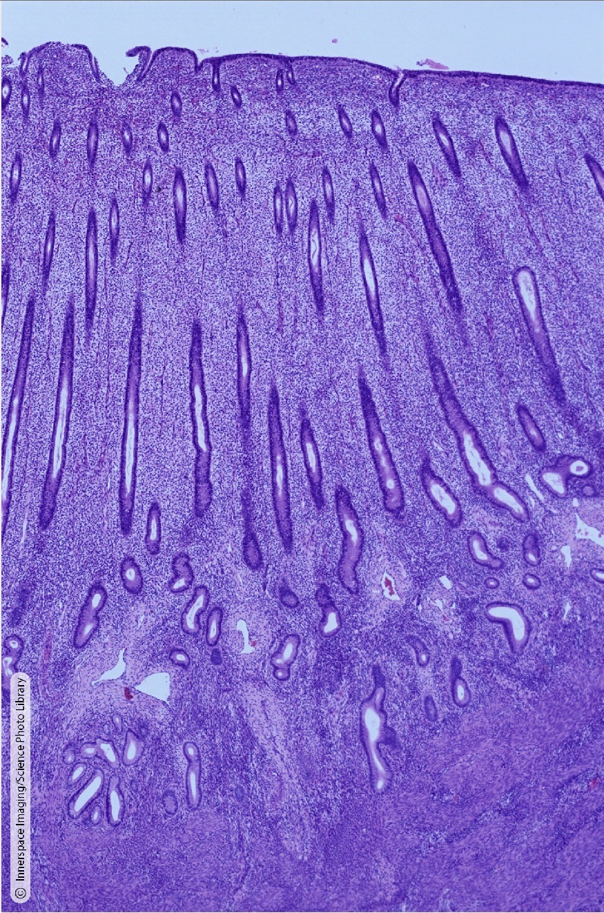 <p>Identify the Histology</p>