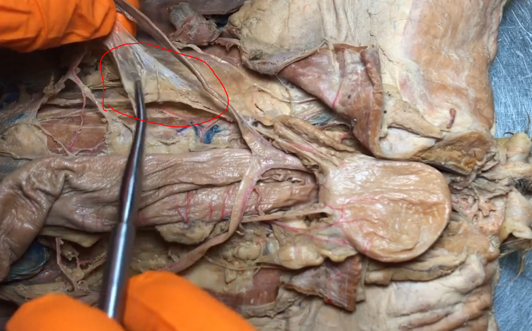 <p>What is this structure</p>