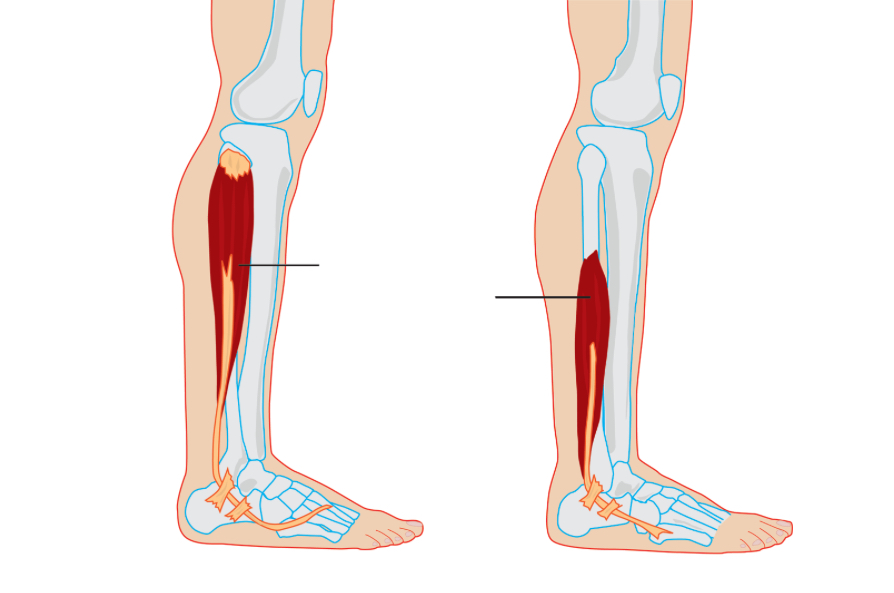 <p>Where is the peroneus longus </p>