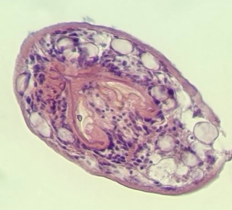 <p>What Helminth is this?</p>