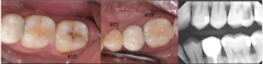 <p>What is the classification for #18?</p>