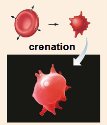 <p>higher concentration outside the cell, causing water to be pulled out of the cell and shrink (crenation)</p>