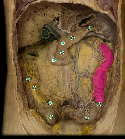 <p>what organ is this</p>