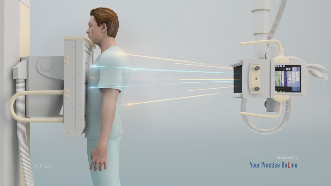 <p><strong>X-ray</strong></p>