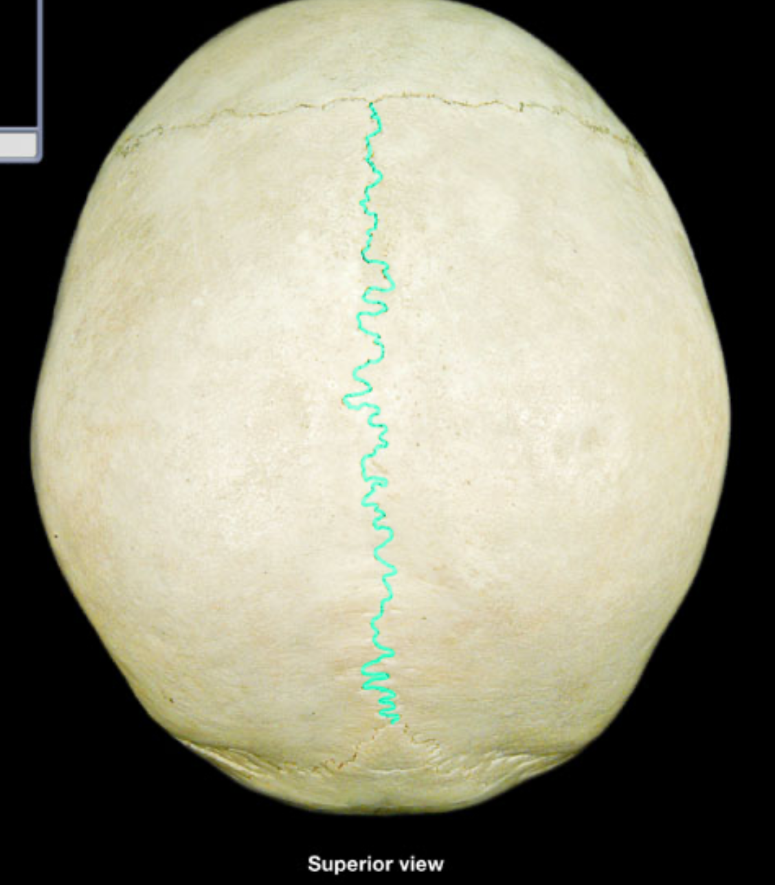 term image