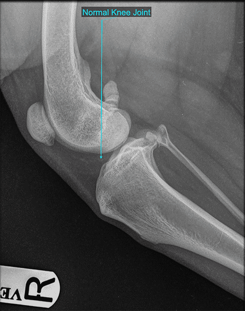 <p>Condylar joints </p>
