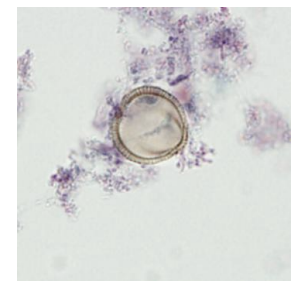 <p>pollen grain in stool that may look like</p>