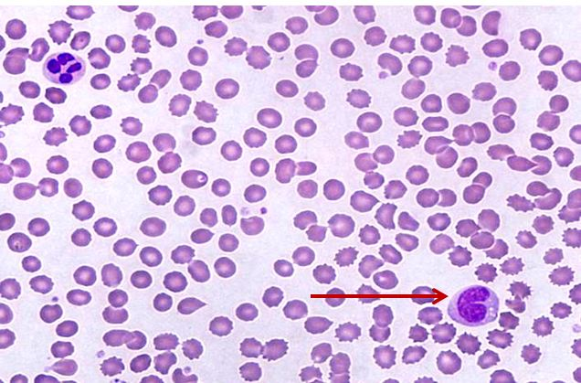 <p>Tế bào gì ?</p>