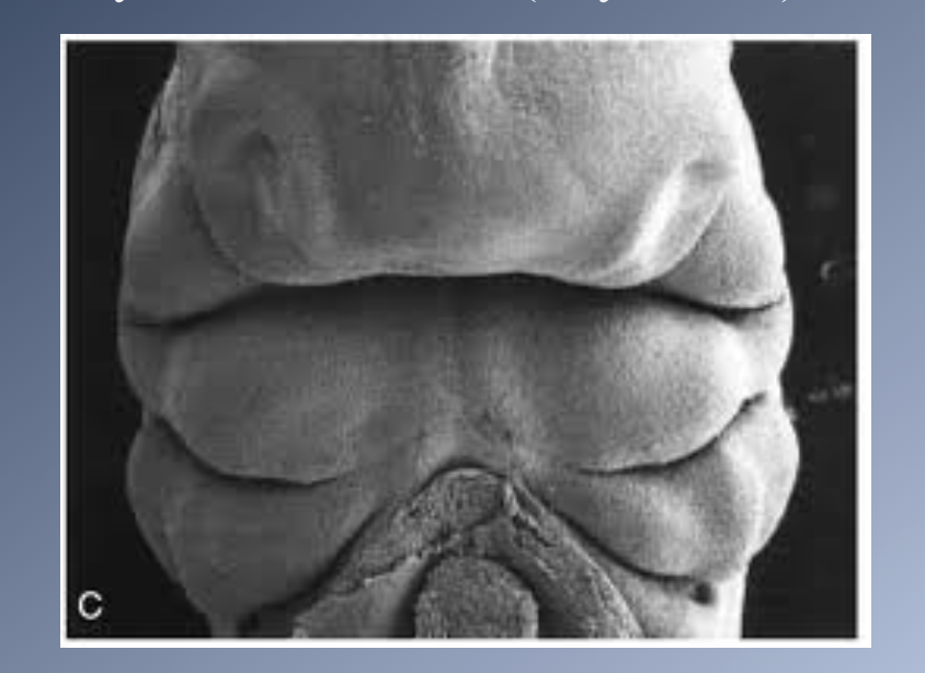 <p><span>PRINCIPAL STAGES IN CRANIOFACIAL DEVELOPMENT</span><br><span>3. Origins, migrations and interactions of cell populations, especially neural crest cells (Days 19-28)</span></p>