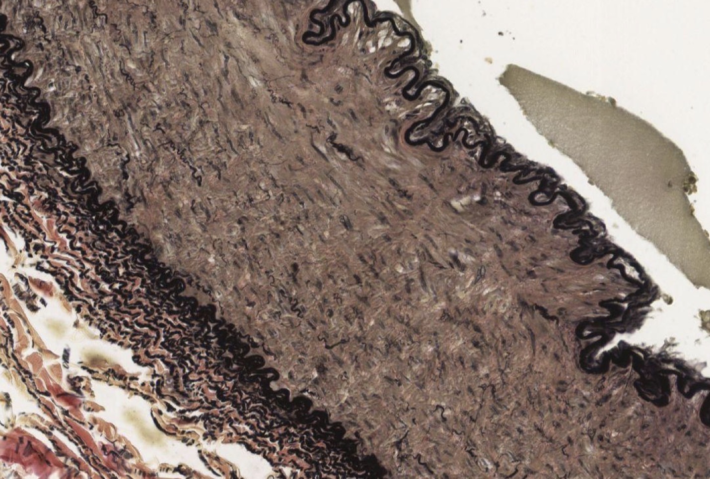 <p>Identify the Vessel and the Layer pictured</p>