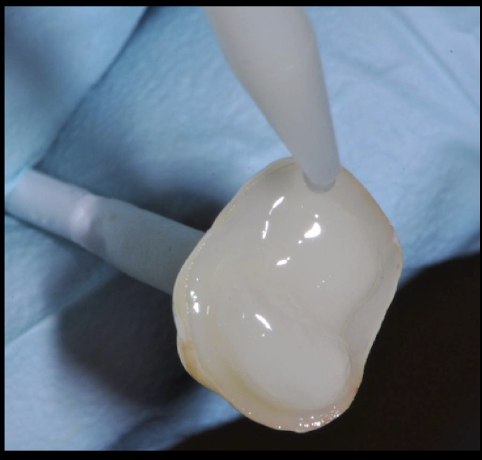 <p>after loading resin cement in restoration, what do you do upon seating </p>