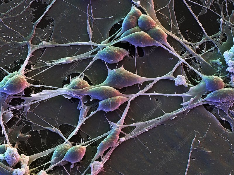 <p>What kind of human cell is this?</p>