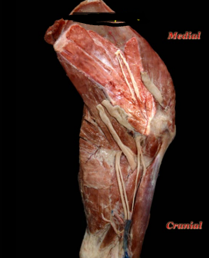 <ol><li><p>origin </p></li></ol><p>subscapular fossa</p><ol start="2"><li><p>insertion</p></li></ol><p>lesser tubercle</p><ol start="3"><li><p>action</p></li></ol><p>adducts limb </p><p>rotates arm medially</p><p></p>