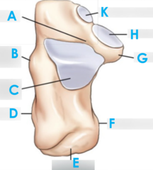 <p>B</p>