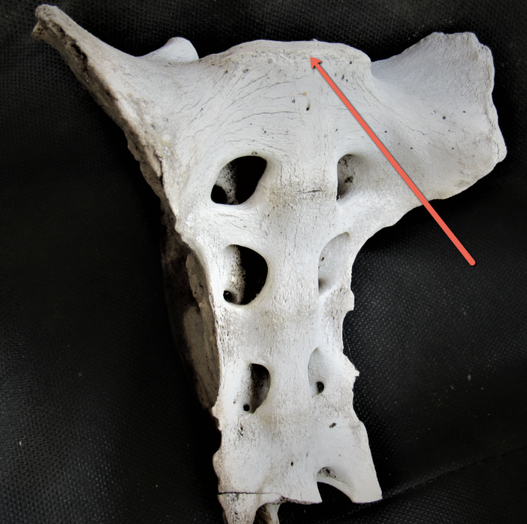 <p><span><strong>Identify the bone marking indicated by the pointer.</strong></span></p>