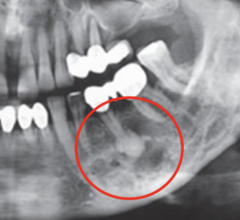 <p>What is the location of this lesion?</p>