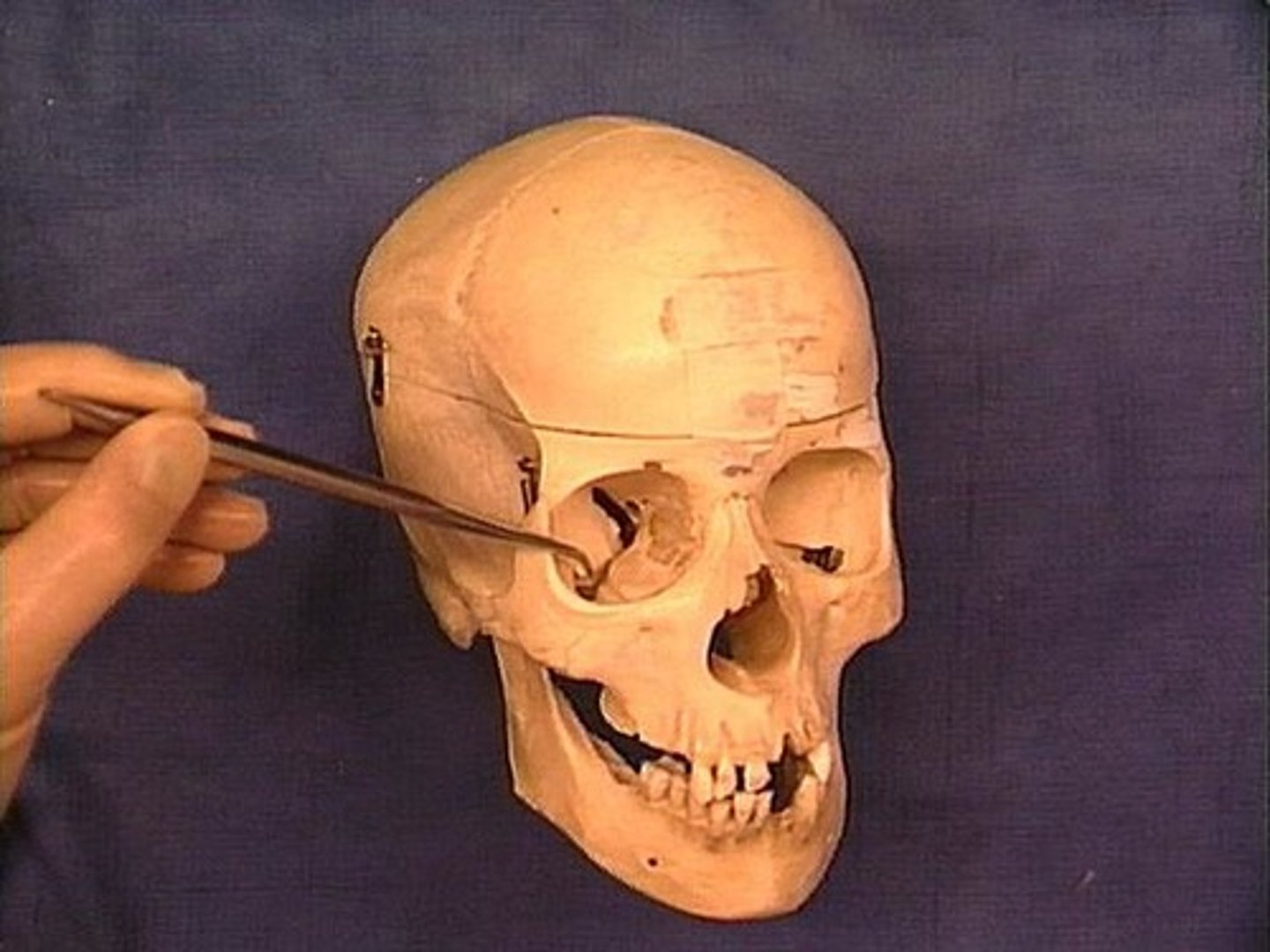 <p>Id opening at tip of pointer</p>