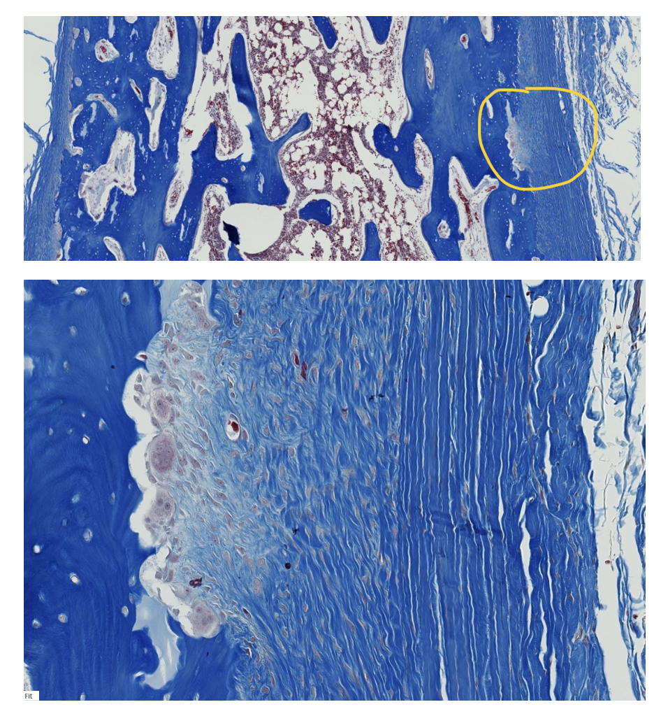 <p><span style="font-family: "Calibri Light";">The upper image is full thickness through the shaft of a long bone, with the external surfaces on the left and right sides of the image.</span></p><p style="text-align: left;"><span style="font-family: "Calibri Light";">The encircled area in the upper image is enlarged in the lower image.</span></p><p style="text-align: left;"></p><p style="text-align: left;"><span style="font-family: "Calibri Light";">1. What do we call the encircled external fibrous membrane (outer CT covering) of bone?<br><br>2. What does “fibrous” refer to in this context?</span></p>