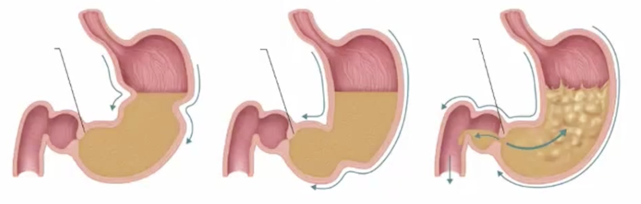 <ul><li><p>propulsion</p></li><li><p>grinding</p></li><li><p>retropulsion</p></li></ul><p></p>