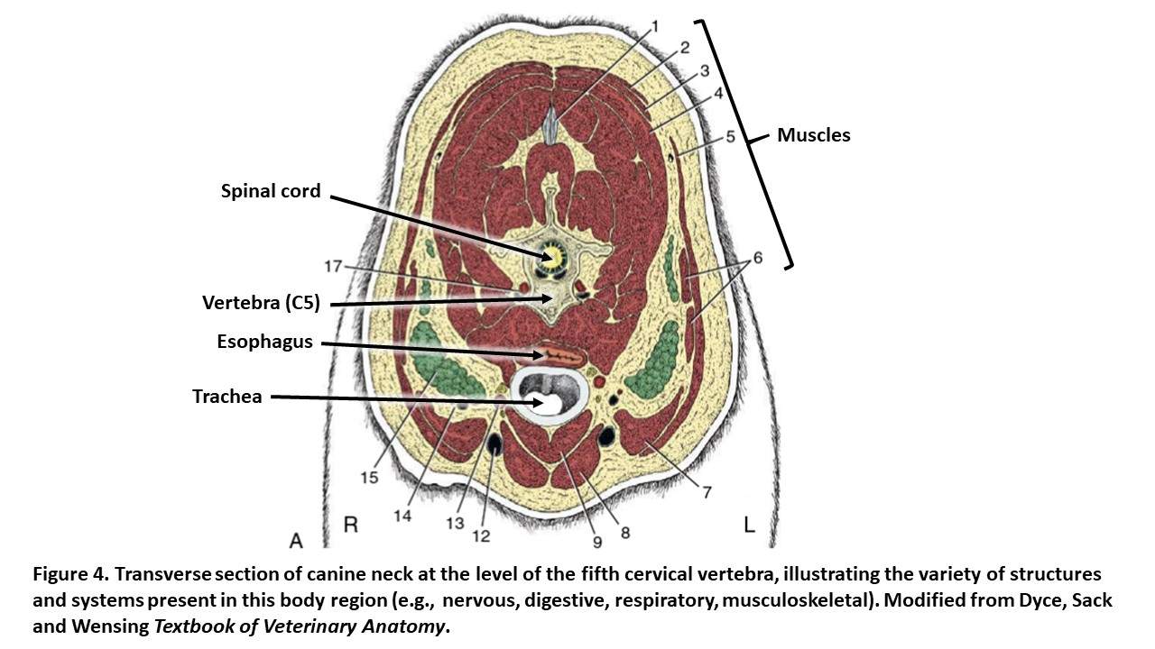 <p>The _____ portion of the neck connects the _____ to the back, that includes the cervical vertebral column and supporting _______. Associated with nervous system.</p>