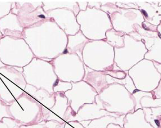 <p>adipose tissue</p>