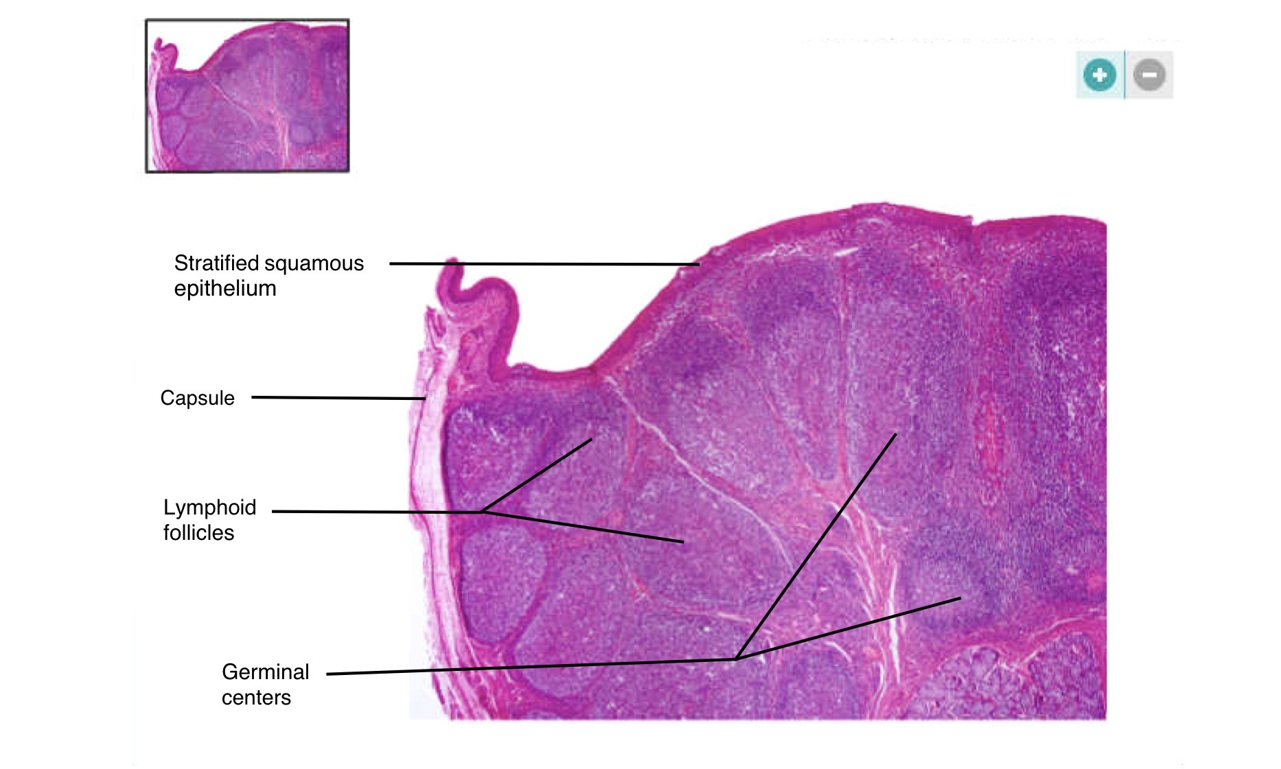 <p>Germinal center, capsule, lymphoid follicle</p>