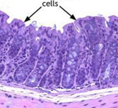 <p>what cells are arrows pointing to (colon)</p>