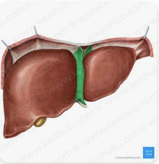 <p>Name this ligament of the liver</p>