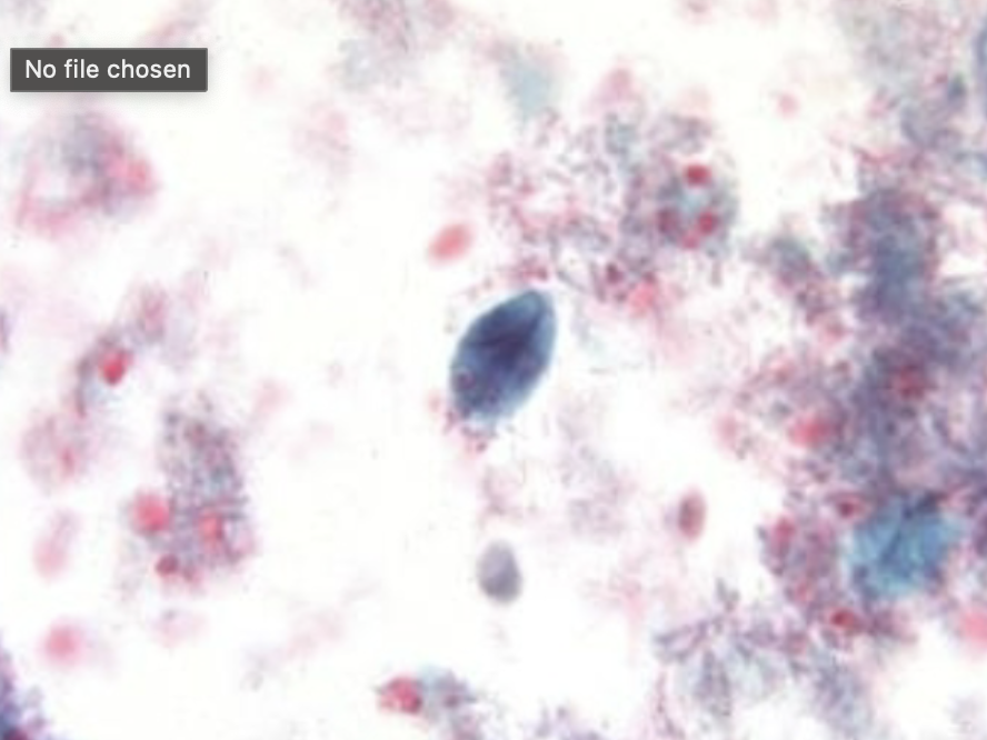 <p>What protist is this? (genus name)</p>