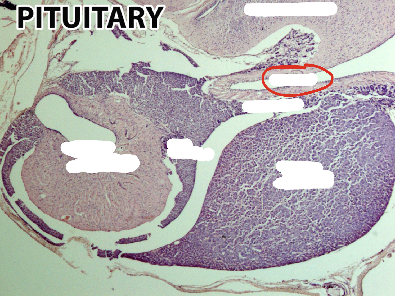 <p>What part of the pituitary is this?</p>
