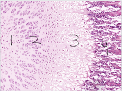 <p>1. Zone of Reserve Cartilage </p><p>2. Zone of Proliferation</p><p>3. Zone of Hypertrophy</p><p>4. Zone of Ossification</p>