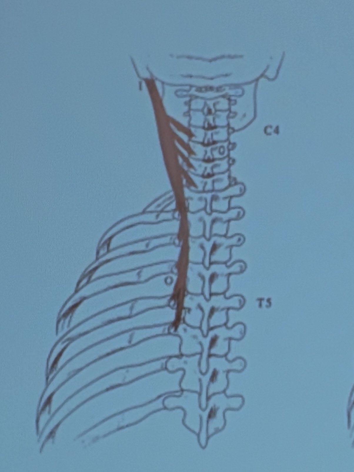 <p>Muscle name?</p>