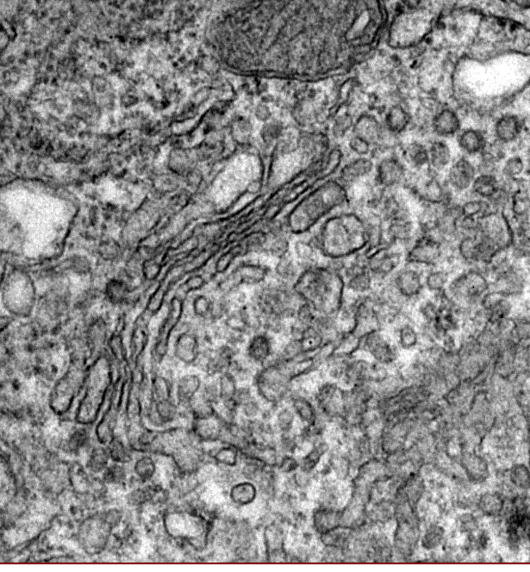 <p>Golgi apparatus </p>