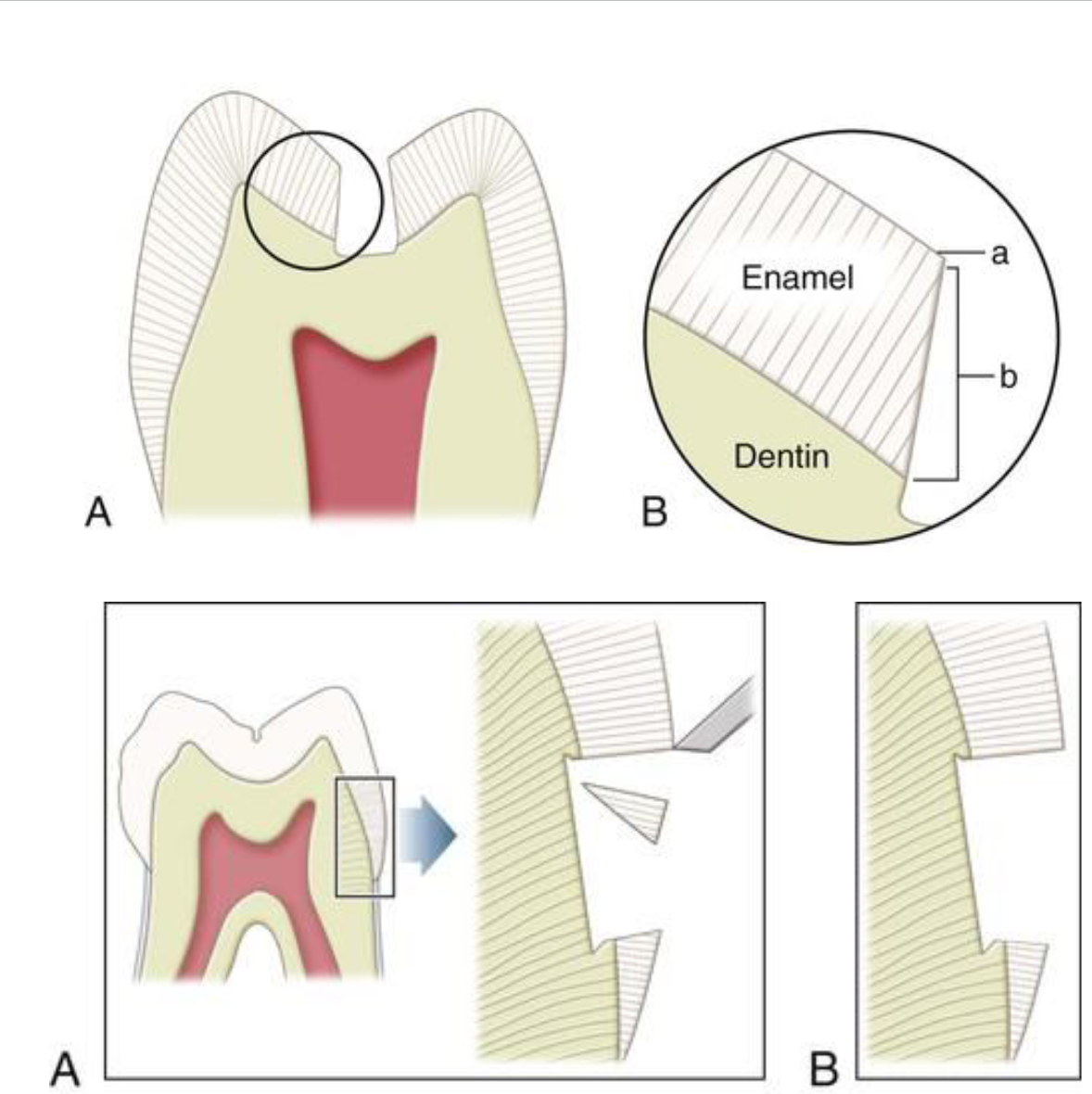 <p>Enamel rods/prisms exit</p><p>perpendicular to tooth surface</p>